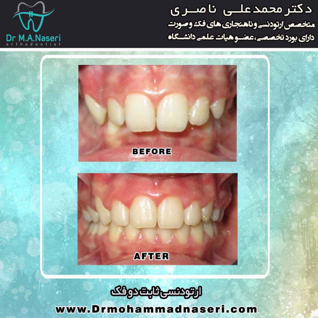 متخصص خوب ارتودنسی در اصفهان