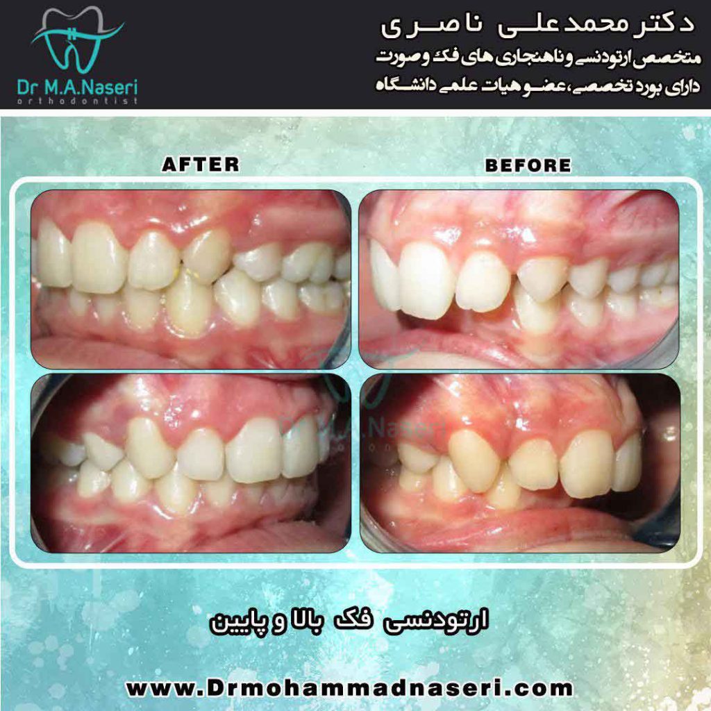 متخصص خوب ارتودنسی در اصفهان