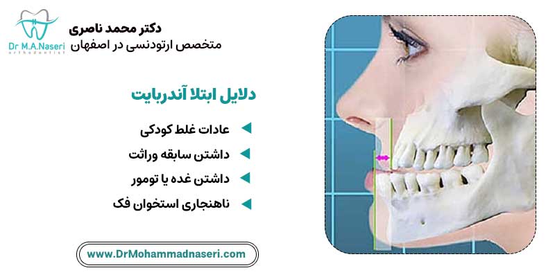 دلایل ابتلا به آندربایت| دکتر محمد ناصری متخصص ارتودنسی اصفهان