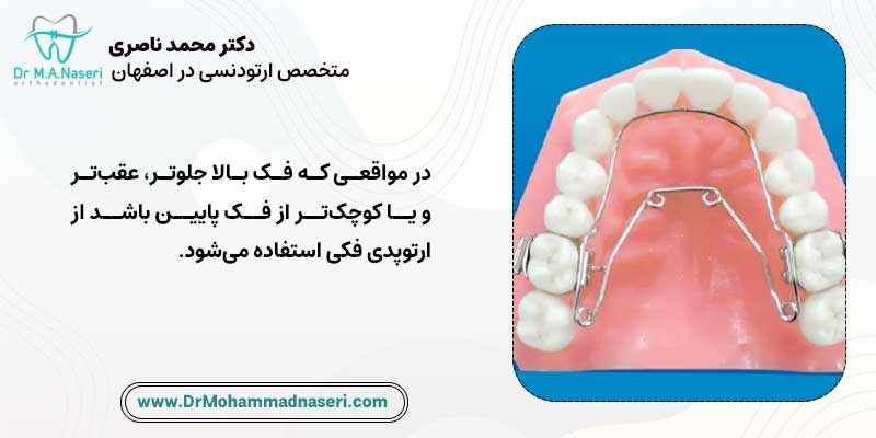 ارتوپدی فک بالا | دکتر محمد ناصری متخصص ارتودنسی اصفهان