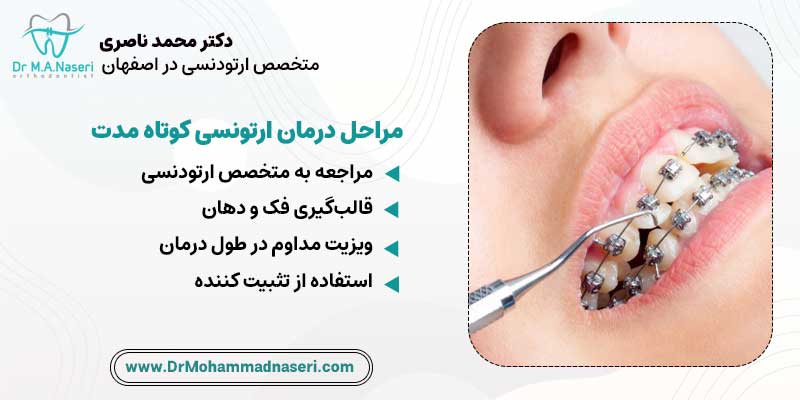 مراحل درمان ارتودنسی سریع | دکتر محمد ناصری متخصص ارتودنسی در اصفهان