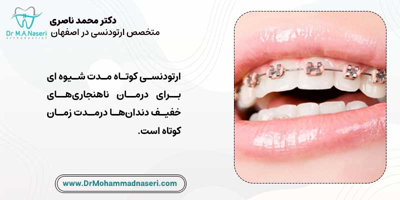 ارتودنسی کوتاه مدت اصفهان | دکتر محمد ناصری متخصص ارتودنسی در اصفهان