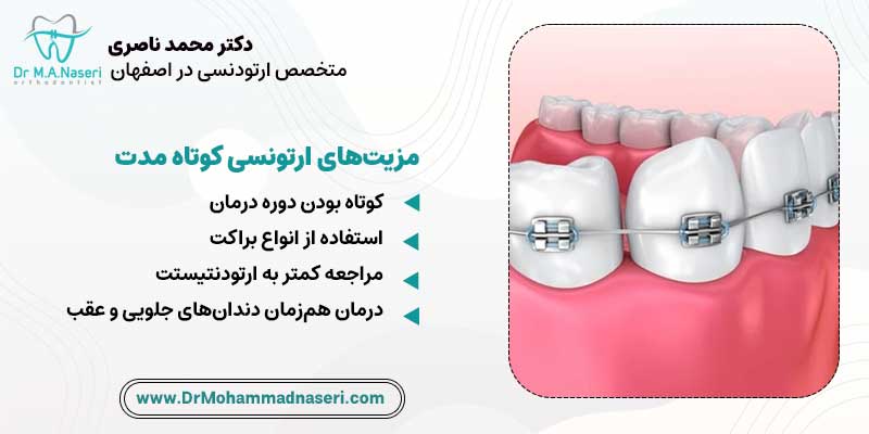 مزیت ارتودنسی کوتاه مدت |دکتر محمد ناصری متخصص ارتودنسی در اصفهان|