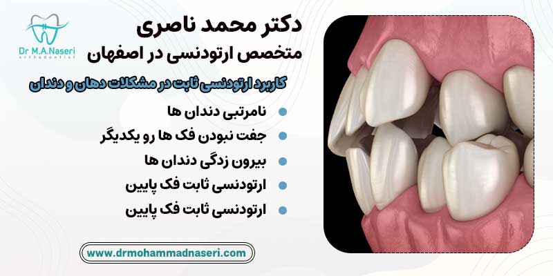کاربرد ارتودنسی ثابت در ناهنجاری های دهان و دندان |دکتر محمد ناصری متخصص ارتودنسی در اصفهان