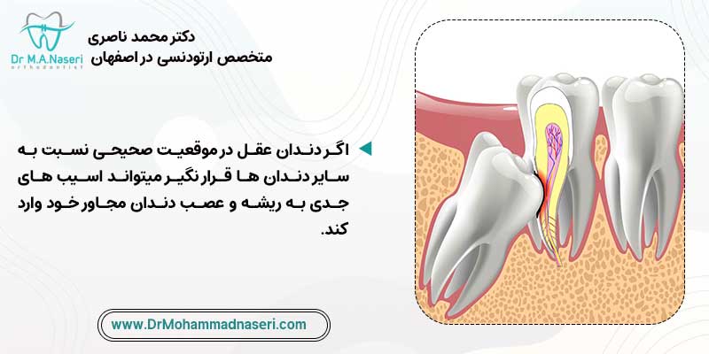عوارض درمان نکردن دندان عقل
