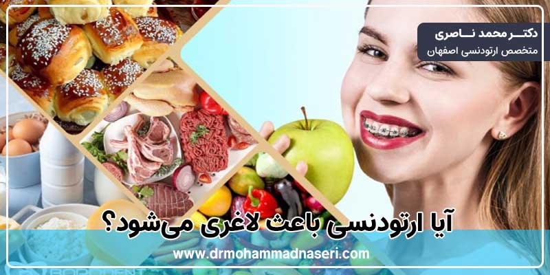 آیا ارتودنسی باعث لاغری میشود؟