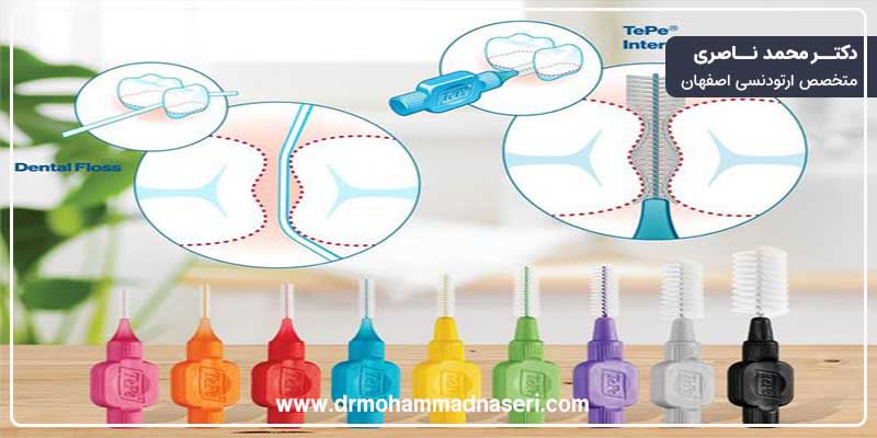 مسواک ونخ دندان مناسب برای تمیز کردن ریتینر ثابت