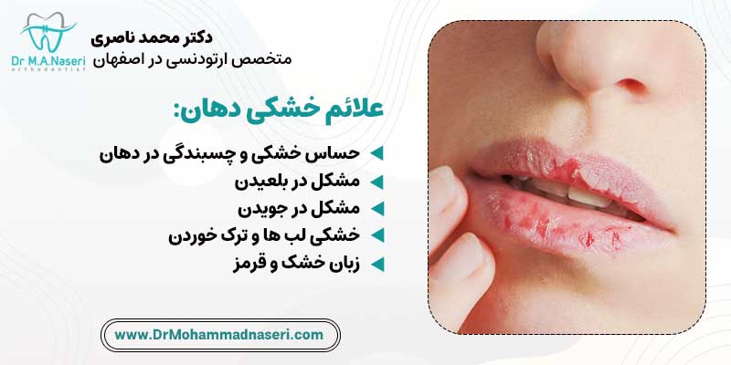 علائم خشکی دهان در ارتودنسی