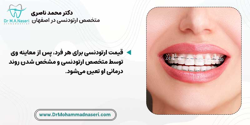 تعیین هزینه ارتودنسی برای هر فرد