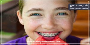 مشکل محدودیت رژیم غذایی در حین درمان ارتودنسی