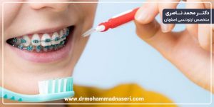  تفاوت مسواک معمولی و مسواک مخصوص ارتودنسی