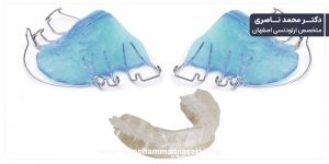 انواع ارتودنسی متحرک 