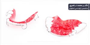 نگهدارنده هاولی