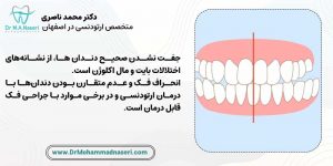 جفت نشدن صحیح دندان ها در اثر عدم انجام ارتودنسی و عواقب ان