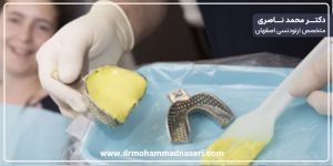 باندینگ ارتودنسی