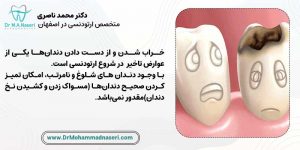 پوسیدگی و خراب شدن دندان ها در اثر به تعویق انداختن درمان ارتودنسی
