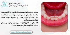 عوارض شلوغی دندان و وجود دندان اضافه در صورت عقب انداختن درمان ارتودنسی