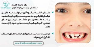 علل بروز دندان غائب در کودکان