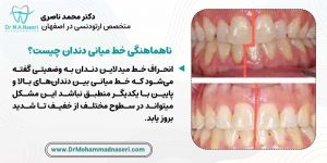 انحراف خط میدلاین دندان چیست؟