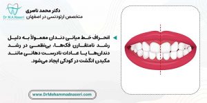 دلایل بروز انحراف خط میانی دندان