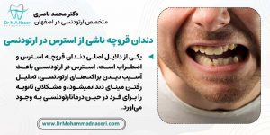 عوارض دندان قروچه استرسی بر درمان ارتودنسی