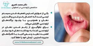 زخم دهان در ارتودنسی به دلیل استرس