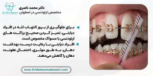 مراقبت از دندان ها در ارتودنسی برای افراد دیابتی