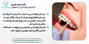 اهمیت انجام ارتودنسی برای افراد مبتلا به سندرم دوان