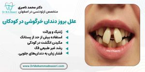 علل بروز دندان خرگوشی در کودکان