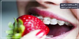 غذاهای مناسب دوران ارتودنسی ثابت و متحرک