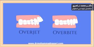 عکس نشان دهنده تفاوت بین اورجت و اوربایت