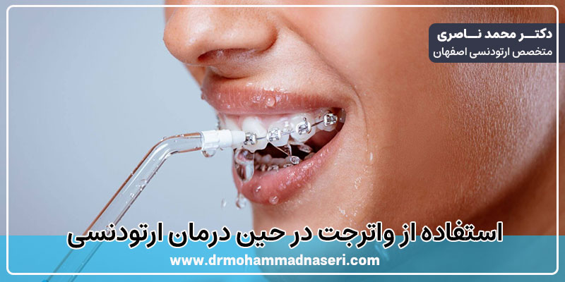 استفاده از واترجت در حین درمان ارتودنسی