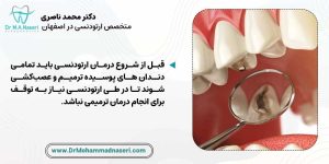 درمان پوسیدگی دندان و التهاب لثه قبل از شروع درمان