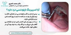 ایا اسپیرینگ ارتودنسی درد دارد؟