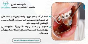 ایا لمینت دندان حین درمان ارتودنسی اسیبی میبیند؟