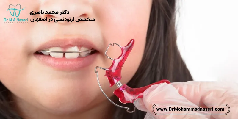 فضا نگهدارنده دندان کودک چیست و چه کاربردی دارد؟ 